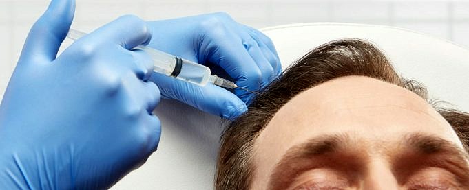 Die Besten Behandlungen Gegen Haarausfall, Sortiert Nach Reihenfolge